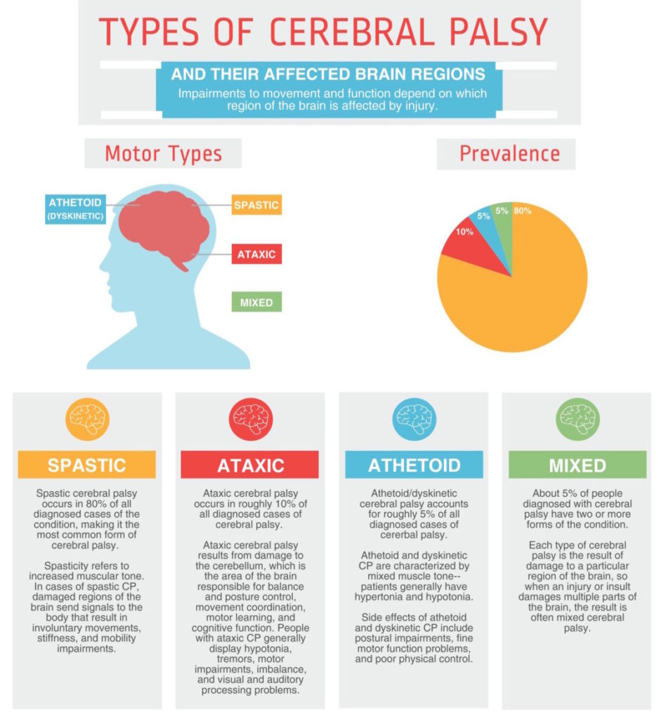 Cerebral Palsy Stem Cell Treatment by StemCells21