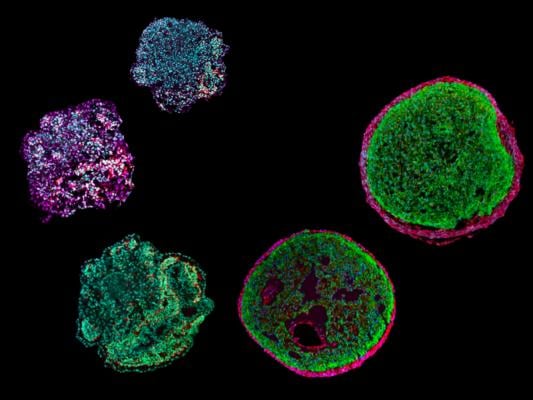 Ein Miniaturherz in einer Petrischale: Organoid ahmt die Entwicklung des menschlichen Herzens nach