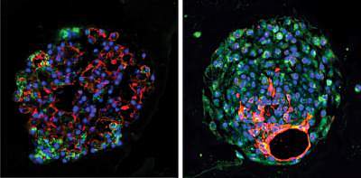 研究人员描述了用干细胞重建、再生肺细胞