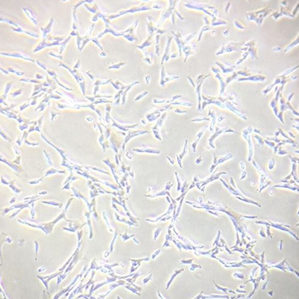 mesenchymale stamcellen, msc, stamcellen, navelstreng msc, volwassen stamcellen, foetale stamcellen,