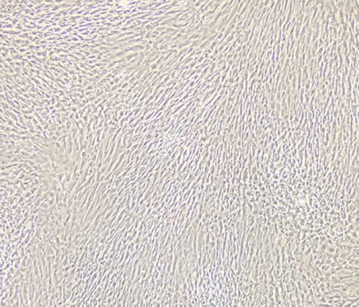mesenchymal stem cells, msc, stem cells, umbilical cord msc, adult stem cells, fetal stem cells, stemcells21,